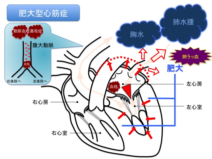 HCMはどのように診断されますか?