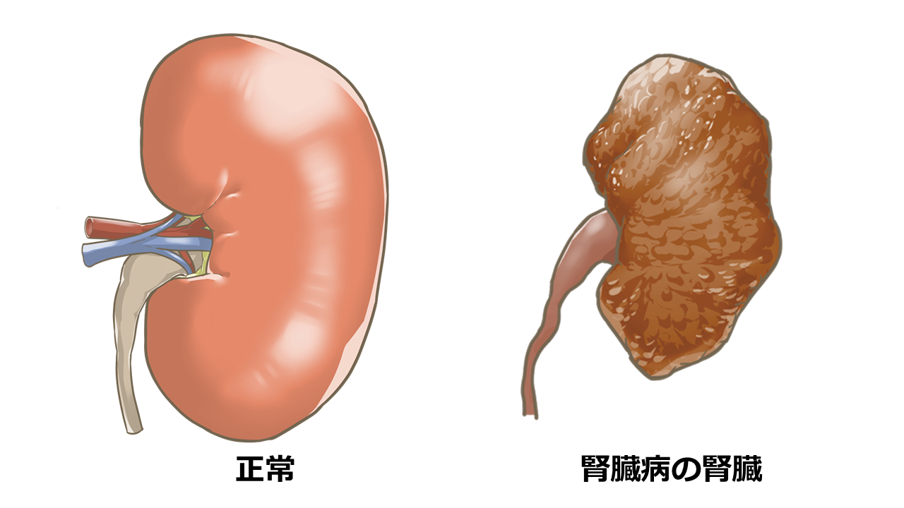 高齢猫に注意 慢性腎臓病について解説します 市川市 浦安市の動物病院 All動物病院行徳 皮膚科 眼科