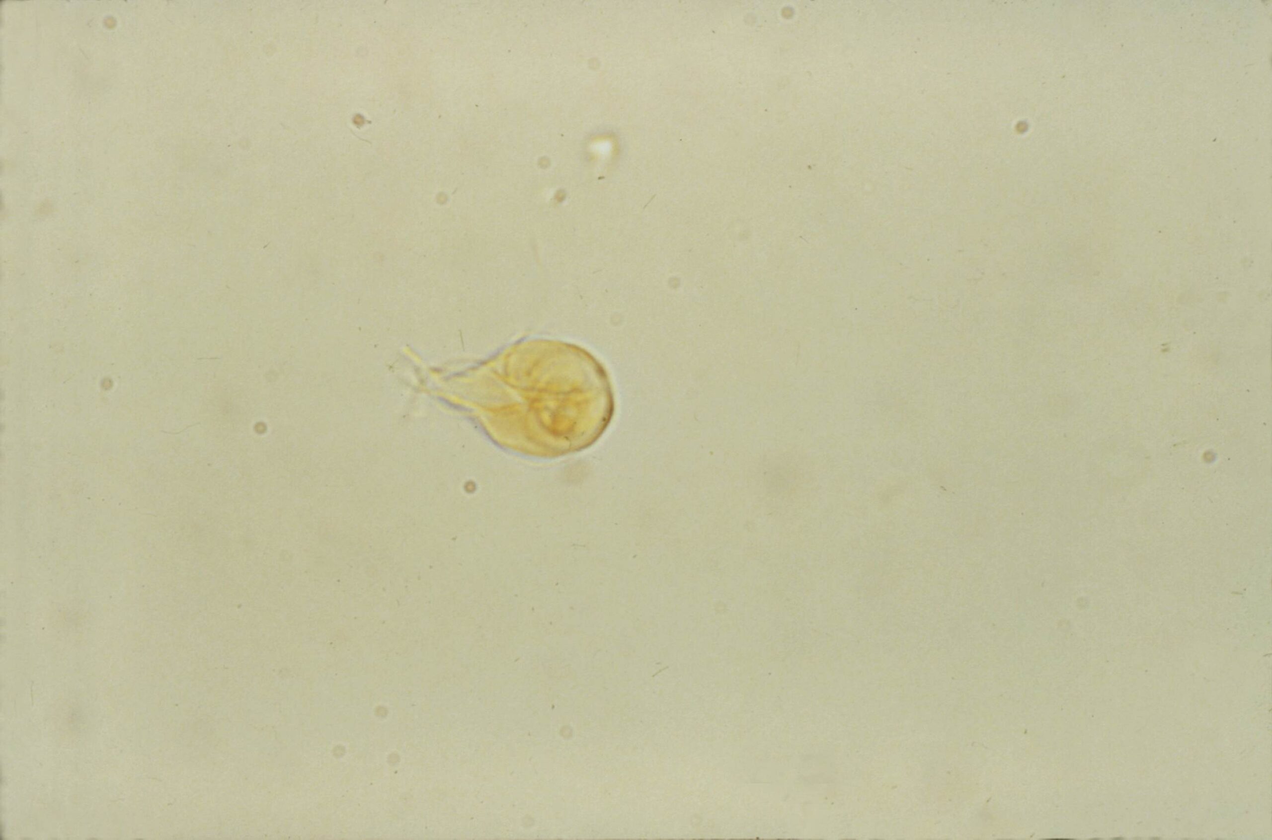 下痢の原因は寄生虫 顕微鏡でしか見えない寄生虫である原虫をご紹介します 市川市 浦安市の動物病院 All動物病院行徳 皮膚科 眼科