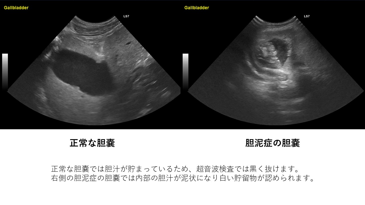 黄疸が出た 胆石 胆嚢粘液嚢腫 胆泥症を解説します 市川市 浦安市の動物病院 All動物病院行徳 皮膚科 眼科