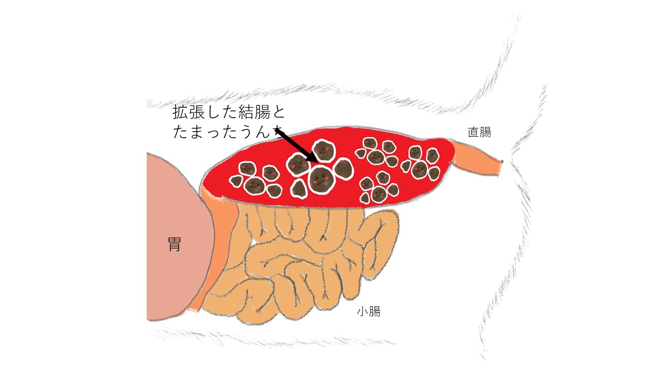 極太うんこイラスト 猫に多い巨大結腸症についてご存じですか？ | 市川市・鎌ケ谷市の動物病院『ALL動物病院グループ』皮膚科/腫瘍科