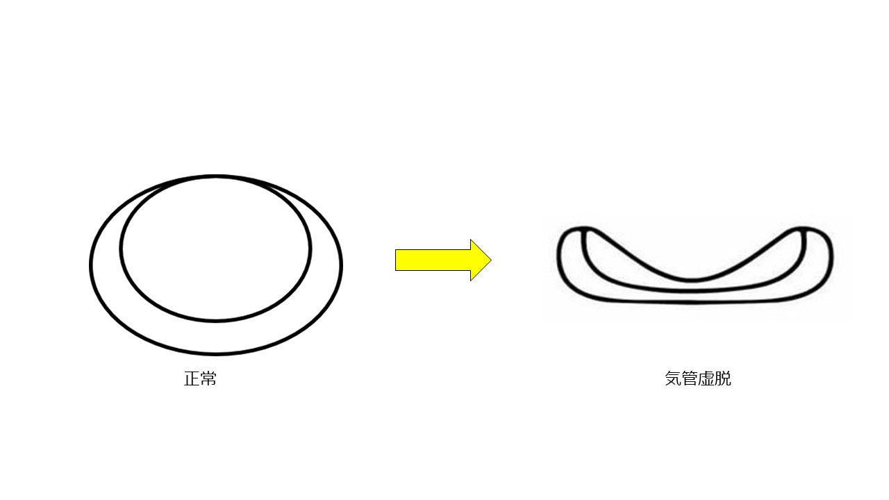 犬のガーガー ブーブー鳴る呼吸って どんなとき 犬の気管虚脱 その症状や予防方法を解説します 市川市 浦安市の動物病院 All動物病院行徳 皮膚科 眼科