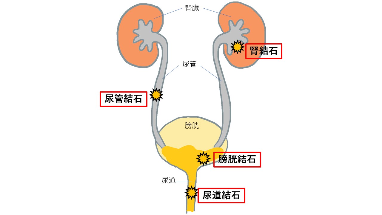 命を落とすこともある怖い病気 尿管結石について解説します 市川市 浦安市の動物病院 All動物病院行徳 皮膚科 眼科