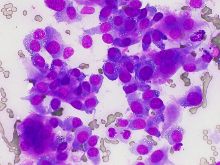 ユーイング肉腫の子供たちの今後の見通しはどうなりますか?