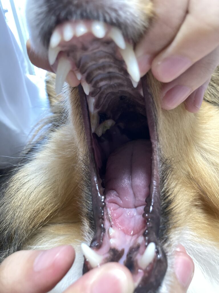 口腔内写真